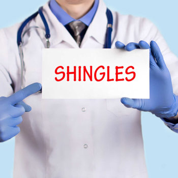 shingles shingles