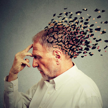 covid and Alzheimers covid and Alzheimers